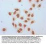 β-hydroxybutyryl-HIST1H3A (K18) Antibody