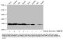Butyrly-HIST1H3A (K18) Antibody