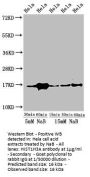Acetyl-HIST1H3A (K23) Antibody