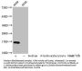 β-hydroxybutyryl-HIST1H3A (K23) Antibody
