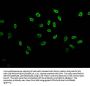 Butyrly-HIST1H3A (K23) Antibody