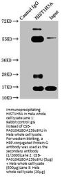 Butyrly-HIST1H3A (K23) Antibody