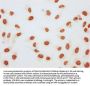 β-hydroxybutyryl-HIST1H3A (K27) Antibody