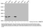 Butyrly-HIST1H3A (K27) Antibody