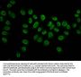 2-hydroxyisobutyryl-HIST1H3A (K27) Antibody
