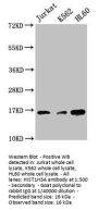 Tri-methyl-HIST1H3A (K27) Antibody