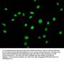 β-hydroxybutyryl-HIST1H3A (K56) Antibody