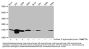β-hydroxybutyryl-HIST1H3A (K79) Antibody