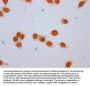 β-hydroxybutyryl-HIST1H3A (K79) Antibody
