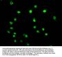 β-hydroxybutyryl-HIST1H3A (K79) Antibody