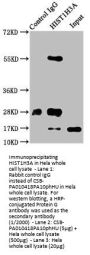Phospho-HIST1H3A (S10) Antibody
