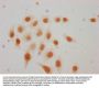 Acetyl-HIST1H3A (K115) Antibody