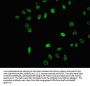 2-hydroxyisobutyryl-HIST1H3A (K18) Antibody