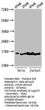 Tri-methyl-HIST1H3A (K36) Antibody