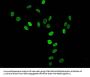 Tri-methyl-HIST1H3A (K36) Antibody
