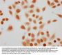 Succinyl-HIST1H3A (K56) Antibody