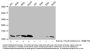β-hydroxybutyryl-HIST1H4A (K5) Antibody