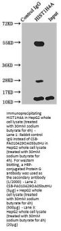 Butyrly-HIST1H4A (K5) Antibody