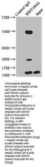 Butyrly-HIST1H4A (K5) Antibody