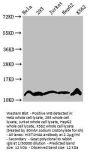 Crotonyl-HIST1H4A (K5) Antibody
