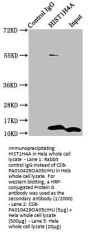 Crotonyl-HIST1H4A (K5) Antibody