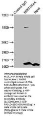 Crotonyl-HIST1H4A (K5) Antibody