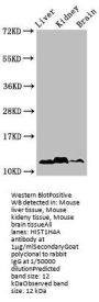 HIST1H4A (Ab-5) Antibody