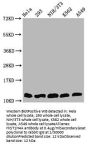 HIST1H4A (Ab-5) Antibody