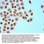 Crotonyl-HIST1H4A (K8) Antibody