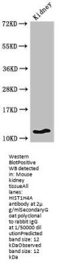 HIST1H4A (Ab-8) Antibody