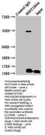 Propionyl-HIST1H4A (K8) Antibody