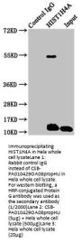 Propionyl-HIST1H4A (K8) Antibody