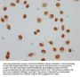 Butyrly-HIST1H4A (K12) Antibody