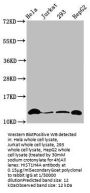 Crotonyl-HIST1H4A (K12) Antibody
