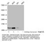 Butyrly-HIST1H4A (K16) Antibody
