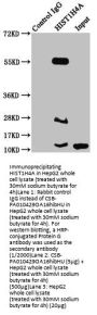 2-hydroxyisobutyryl-HIST1H4A (K16) Antibody