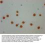 Butyrly-HIST1H4A (K31) Antibody