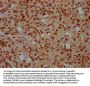 HIST1H4A (Ab-44) Antibody