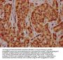 HIST1H4A (Ab-44) Antibody