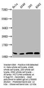 HIST1H4A (Ab-44) Antibody