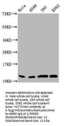 HIST1H4A (Ab-44) Antibody