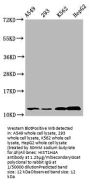 O-GlcNAcyl-HIST1H4A (S47) Antibody