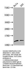 Mono-methyl-HIST1H4A (K59) Antibody