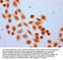 Formyl-HIST1H4A (K77) Antibody