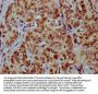 HIST1H4A (Ab-77) Antibody