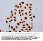 Formyl-HIST1H4A (K91) Antibody
