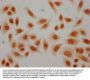 2-hydroxyisobutyryl-HIST1H4A (K44) Antibody