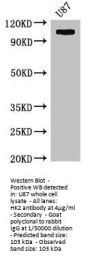 HK2 Antibody