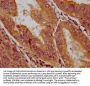 HLCS Antibody