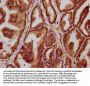 HLCS Antibody